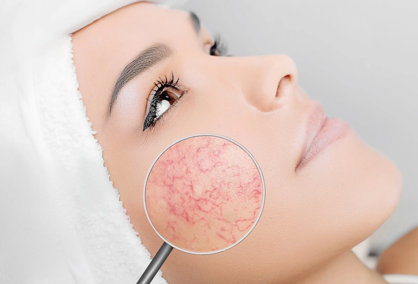 Hassas Ciltlerde Kızarıklık ve Rosacea: Nazik Bakım Rehberi